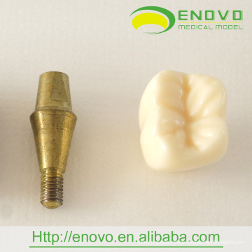 EN-T18 Two Parts New Implant Model for Dental Promotion Gift